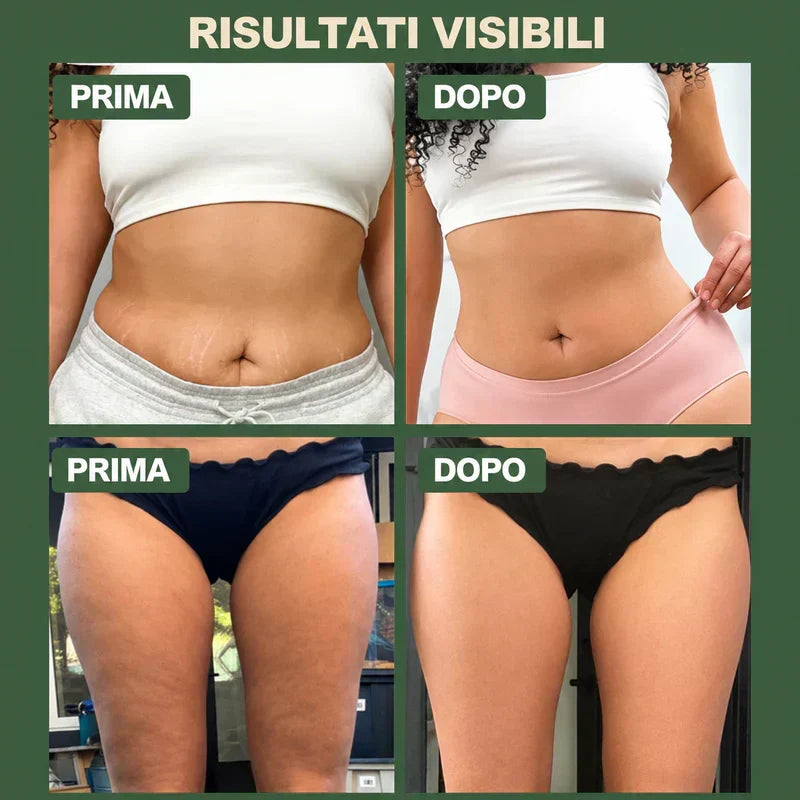 Coppetta Elettrica Anticellulite con Riscaldamento e Aspirazione
